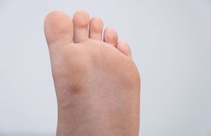 Reconnaître et Gérer une Verrue Morte : Guide Pratique Gérer une Verrue Morte
