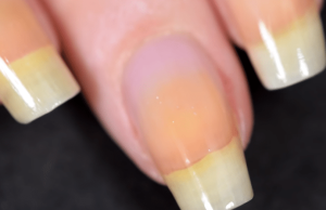 Ongles Jaunes après le Vernis : Causes et Solutions Efficaces Ongles Jaunes après le Vernis
