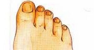 Décryptage du Pied Égyptien : Caractéristiques et Impacts Sur la Santé Pied Égyptien