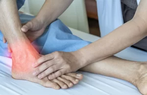 Douleur Externe du Pied et Nerf Sural: Causes et Solutions Douleur Externe du Pied et Nerf Sural