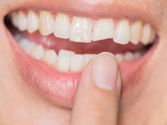 Dent cassée : premiers gestes à adopter avant de voir un dentiste dent cassée : que faire en attendant le dentiste