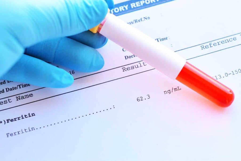 ferritine-elevee-et stress