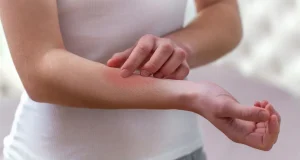 Troubles digestifs après avoir mangé de l’aubergine : allergie ou intolérance ? problèmes gastro-intestinaux allergie aubergine