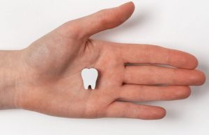 Dent sur pivot qui tombe : que faire rapidement ? Dent sur pivot qui tombe