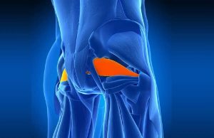 Combien de temps dure le syndrome du piriforme ? combien-de-temps-dure-le-syndrome-du-piriforme