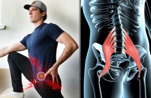 Douleur psoas : lien possible avec les intestins ? douleur-psoas-et-intestin