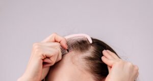 Bouton au cuir chevelu : causes, traitement et solutions rapides bouton-au-cuir-chevelu