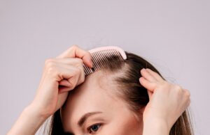 Bouton au cuir chevelu : causes, traitement et solutions rapides bouton-au-cuir-chevelu