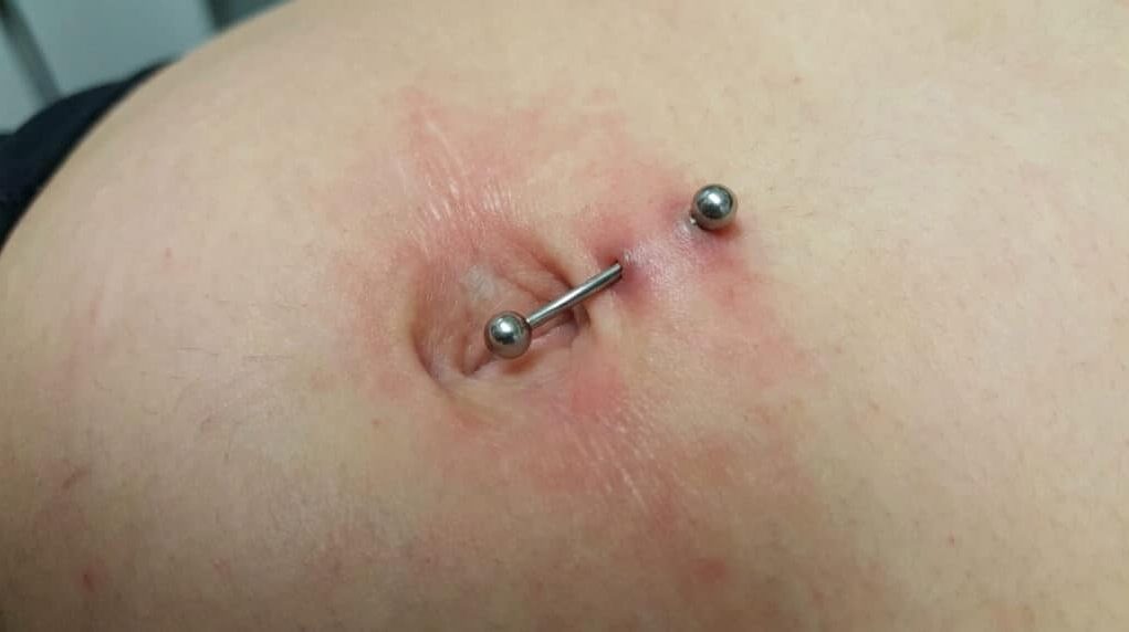 piercing-au-nombril-rejet piercing-au-nombril-rejet