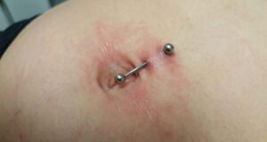 Piercing au nombril rejet : causes, symptômes et solutions piercing-au-nombril-rejet