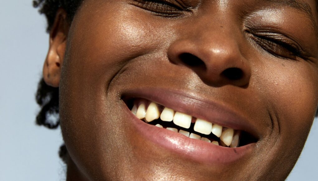 dents-du-bonheur dents-du-bonheur