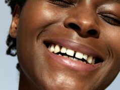 Dents du bonheur : faut-il corriger ce détail ou l’assumer ? dents-du-bonheur