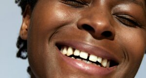 Dents du bonheur : faut-il corriger ce détail ou l’assumer ? dents-du-bonheur
