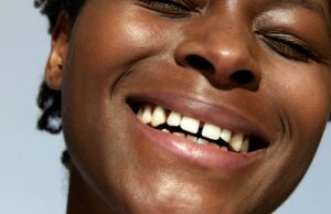 Dents du bonheur : faut-il corriger ce détail ou l’assumer ? dents-du-bonheur