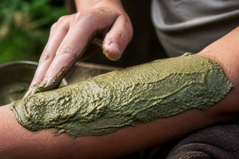 Application d'une couche épaisse d'argile verte sur la peau pour maintenir l'humidité du cataplasme.